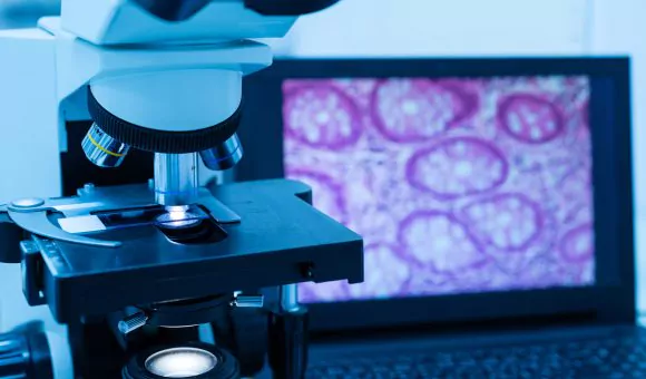 “Chúng tôi chưa làm tốt công việc” - Quan điểm của một chuyên gia giải phẫu bệnh về vấn đề điều trị đích ung thư phổi