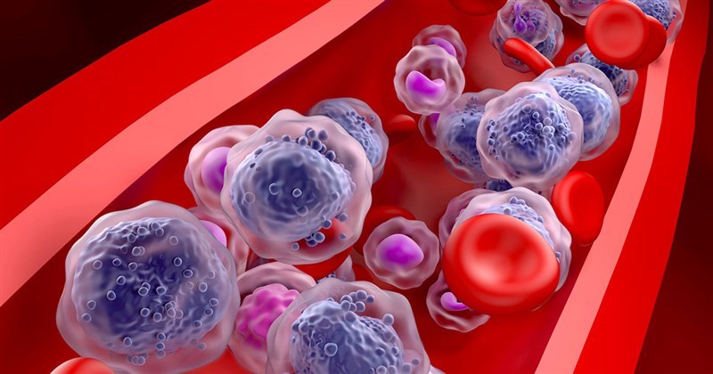 Triển vọng mới trong điều trị bệnh bạch cầu bằng cách hướng đến tế bào gốc của nó