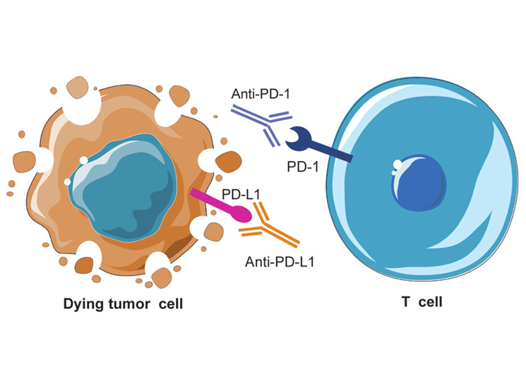 Hiệu quả điều trị ung thư của thuốc ức chế điểm kiểm soát miễn dịch được cải thiện khi kết hợp với xạ trị