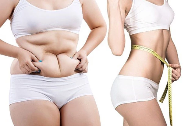 Việc giảm béo có thể bị cản trở do các tế bào mỡ lưu giữ ký ức về tình trạng béo phì