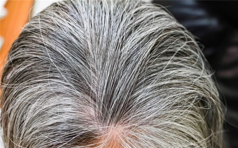 Hiện tượng bạc tóc có thể là cơ chế phòng vệ tự nhiên chống lại ung thư
