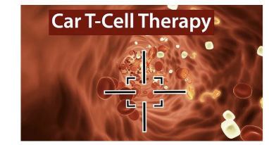 Liệu pháp CAR-T và sự liên quan đến ung thư thứ phát – kết quả phân tích trên 783 bệnh nhân