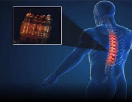 Phương pháp đột phá kết hợp công nghệ tế bào gốc và in 3D để tái tạo sợi thần kinh, phục hồi chấn thương tủy sống