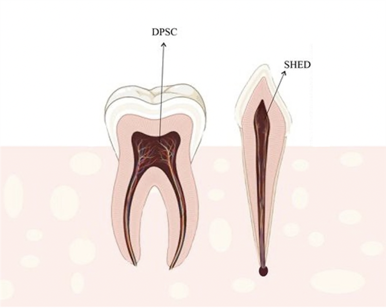 Tính đa tiềm năng và điều hòa miễn dịch của tế bào gốc tủy răng sữa