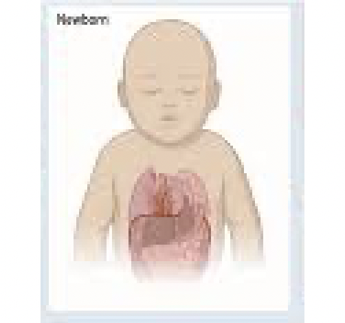 Liệu pháp tế bào gốc trung mô (MSC) từ dây rốn có thể cải thiện chức năng gan ở trẻ sơ sinh bị teo đường mật