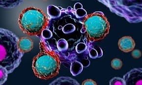 Thảo luận về Orca-T, một liệu pháp tế bào mới có thể thay ghế ghép tế bào gốc tạo máu đồng loại (alloHSCT)