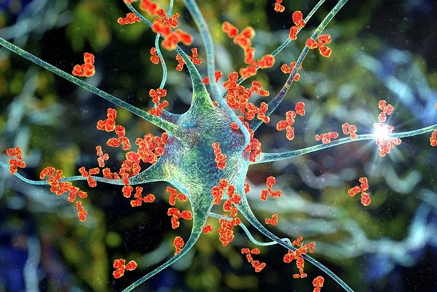 Bệnh tự miễn: khi hệ miễn dịch bảo vệ cơ thể quay lại tấn công tế bào khỏe mạnh