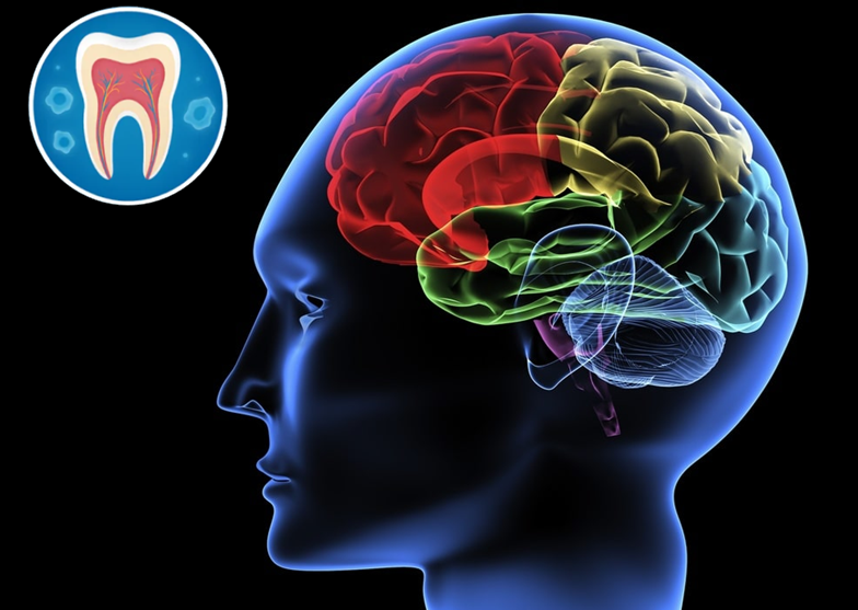 Tế bào gốc từ răng sữa cho thấy tiềm năng trong điều trị bại não