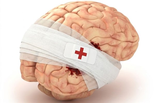 Liệu pháp tế bào gốc trong điều trị chấn thương sọ não